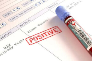 HIV e Coronavirus: soggetti a rischio?