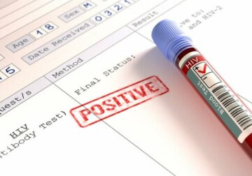 HIV e Coronavirus: soggetti a rischio?