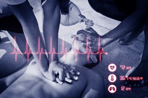 Manovra per arresto cardiorespiratorio