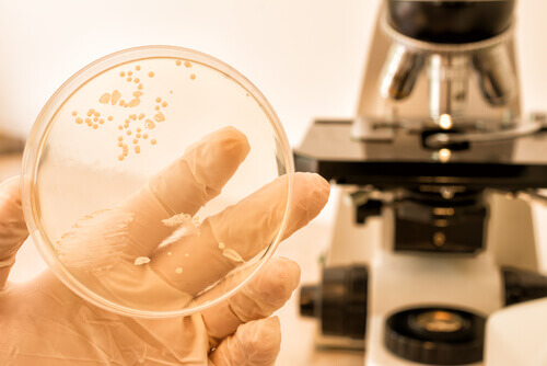 Coltura candida albicans