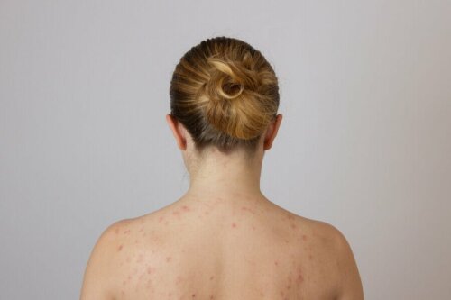 Diagnosi differenziale per noduli di grasso