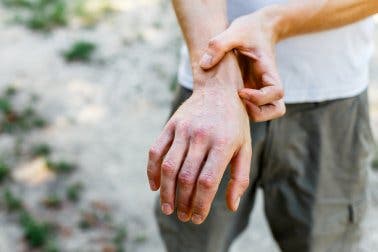 Uomo che si gratta la mano