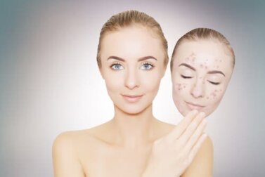 Creme depigmentanti: cosa sono e come applicarle