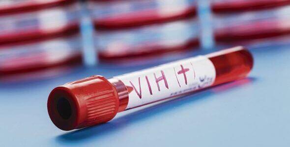 Provetta con sangue infetto da HIV