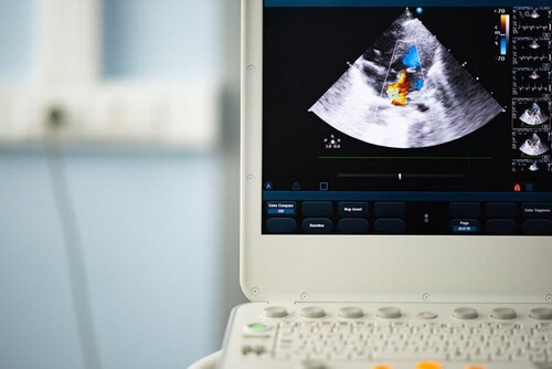 Valvola aortica bicuspide: diagnosi e trattamento