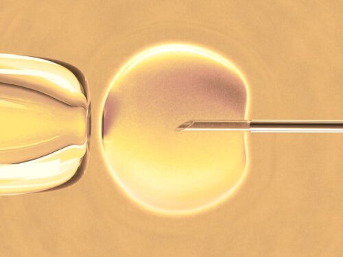 Fecondazione in vitro