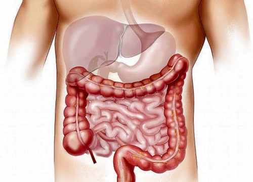 Malattia infiammatoria intestinale