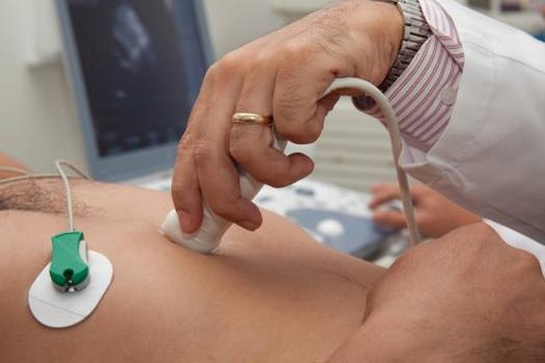 Valvola aortica bicuspide