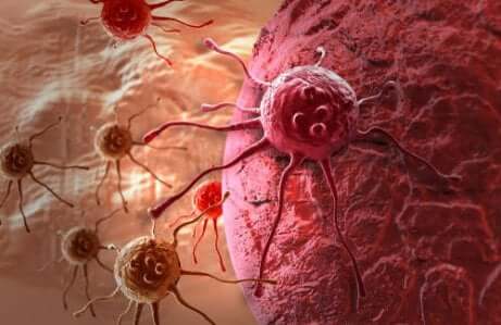 Cellule cancerose nell'organismo.
