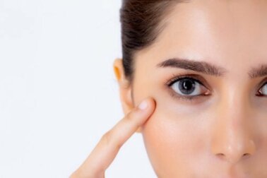 Coprire le macchie con il trucco: consigli di bellezza
