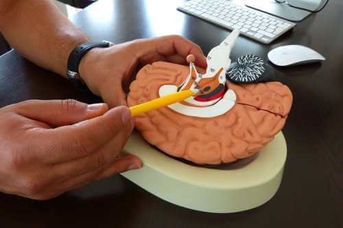Modellino di orecchio e cervello per agopuntura auricolare