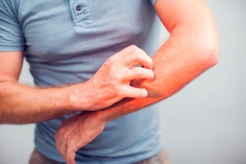 Uomo che si gratta il braccio