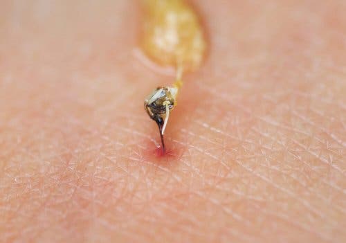 Pungiglione di un'ape