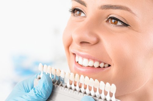 Sbiancamento dei denti: cos’è e quali tecniche esistono