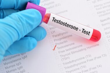 Deficit di testosterone: di cosa si tratta?