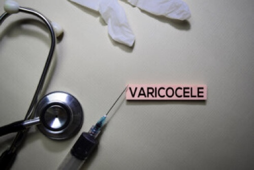 Complicanze da varicocele: tutto quello che c'è da sapere