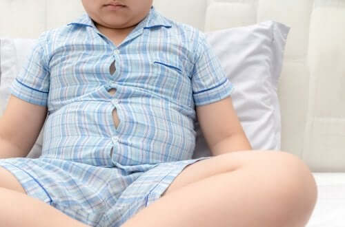 Malattie associate all’obesità infantile