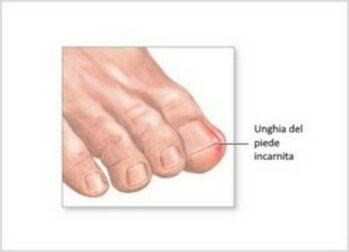 Come tagliare le unghie di mani e piedi