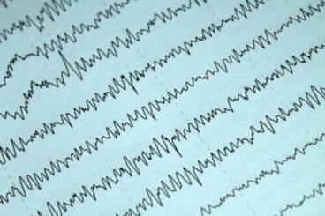 Allattamento al seno ed epilessia: come comportarsi?