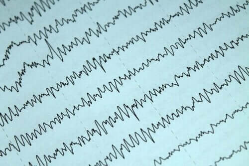 Allattamento al seno ed epilessia: come comportarsi?