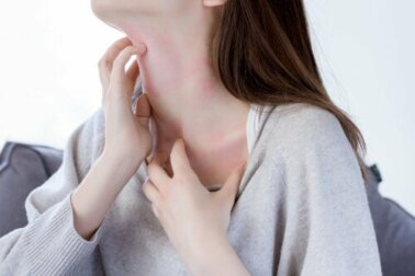 Fotosensibilità causata dai farmaci