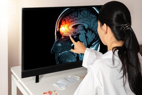 Meningi: cosa sono e quali funzioni svolgono?