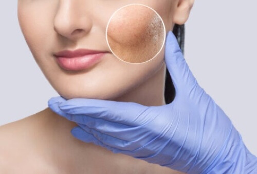 Visita dermatologica per valutare lo stato della pelle.