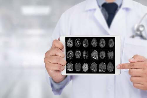 Radiografia del cervello.