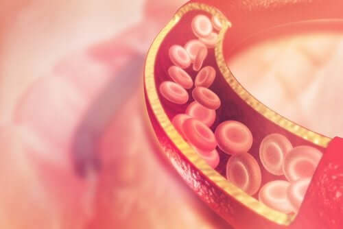 La tromboflebite è un processo infiammatorio del sangue.