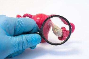 Ovariectomia preventiva, cosa c'è da sapere