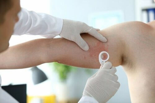 Rash cutanei: tipi principali e cause?