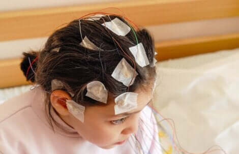 Elettroencefalogramma per diagnosticare l'epilessia infantile.