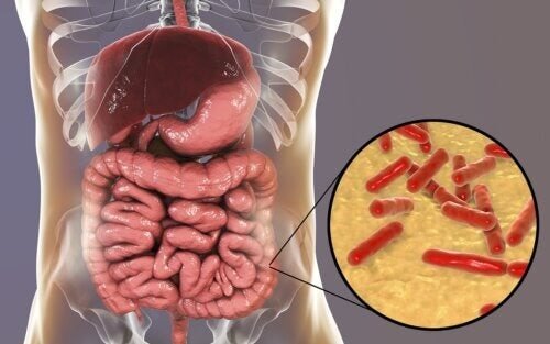 Flora intestinale alterata: quali sono i sintomi?