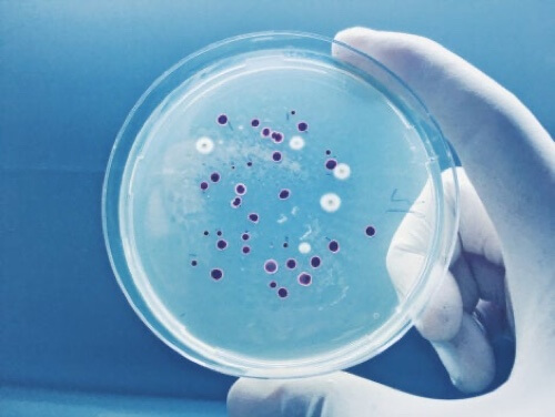 Piastra di Petri con coltura.