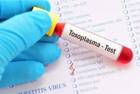 L'esame sierologico per rilevare gli anticorpi in seguito a un'infezione da Toxoplasma.