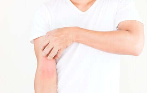 Il rash cutaneo è un arrossamento della pelle.