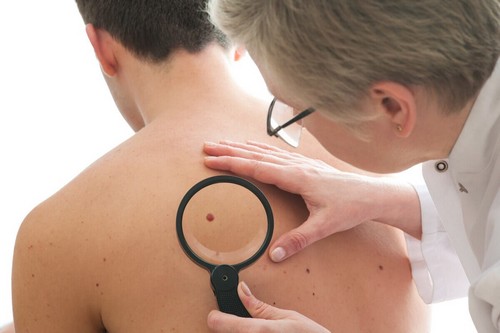 Visita dermatologica per analizzare i nei.