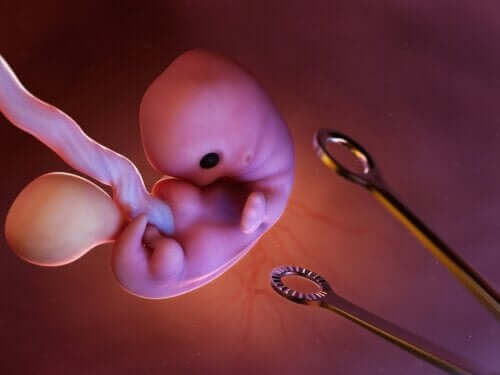 Aborto indotto: quali procedure sono previste?