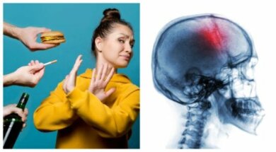 Misure preventive contro l'ictus: 7 sane abitudini