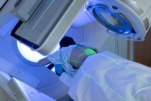 Paziente sottoposto a radioterapia.