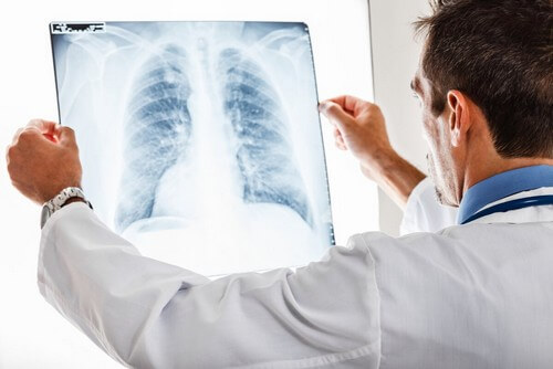 Medico che osserva una radiografia polmonare.