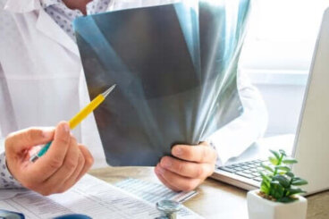 Edema osseo: tutto quello che c'è da sapere