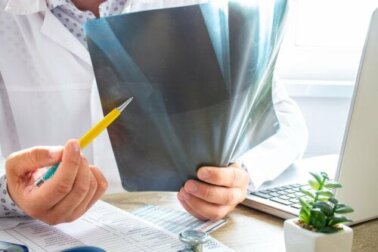 Edema osseo: tutto quello che c'è da sapere