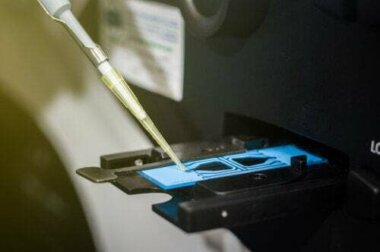 Interpretare lo spermiogramma in modo corretto