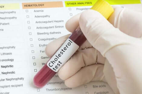 Test per il colesterolo.