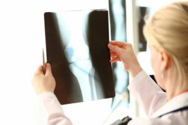 Cibi ricchi di calcio e vitamina D per la salute delle ossa