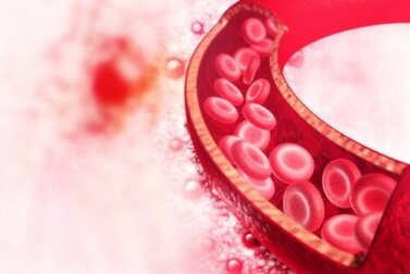 Displasia fibromuscolare: diagnosi e trattamento