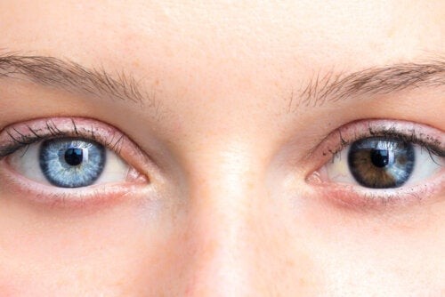 Occhi di colore diverso: c’è da preoccuparsi?