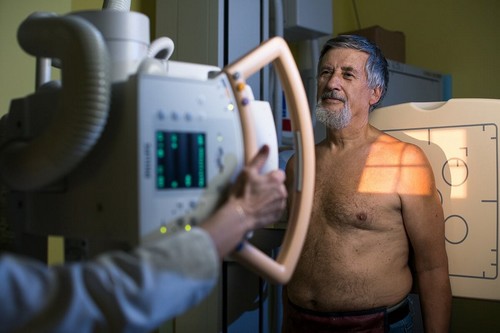 TAC per la diagnosi di broncopneumopatia cronica ostruttiva.