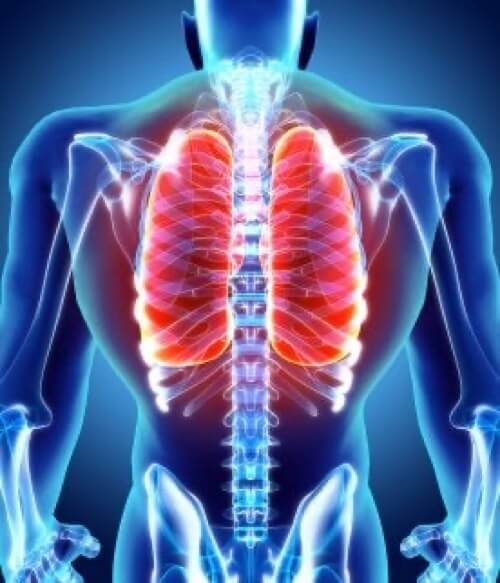 Radiografia dei polmoni.